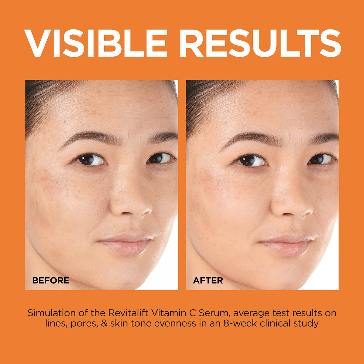 Vitamin C Brightening Face Serum with Vitamin E, Salicylic Acid, 1 oz V276