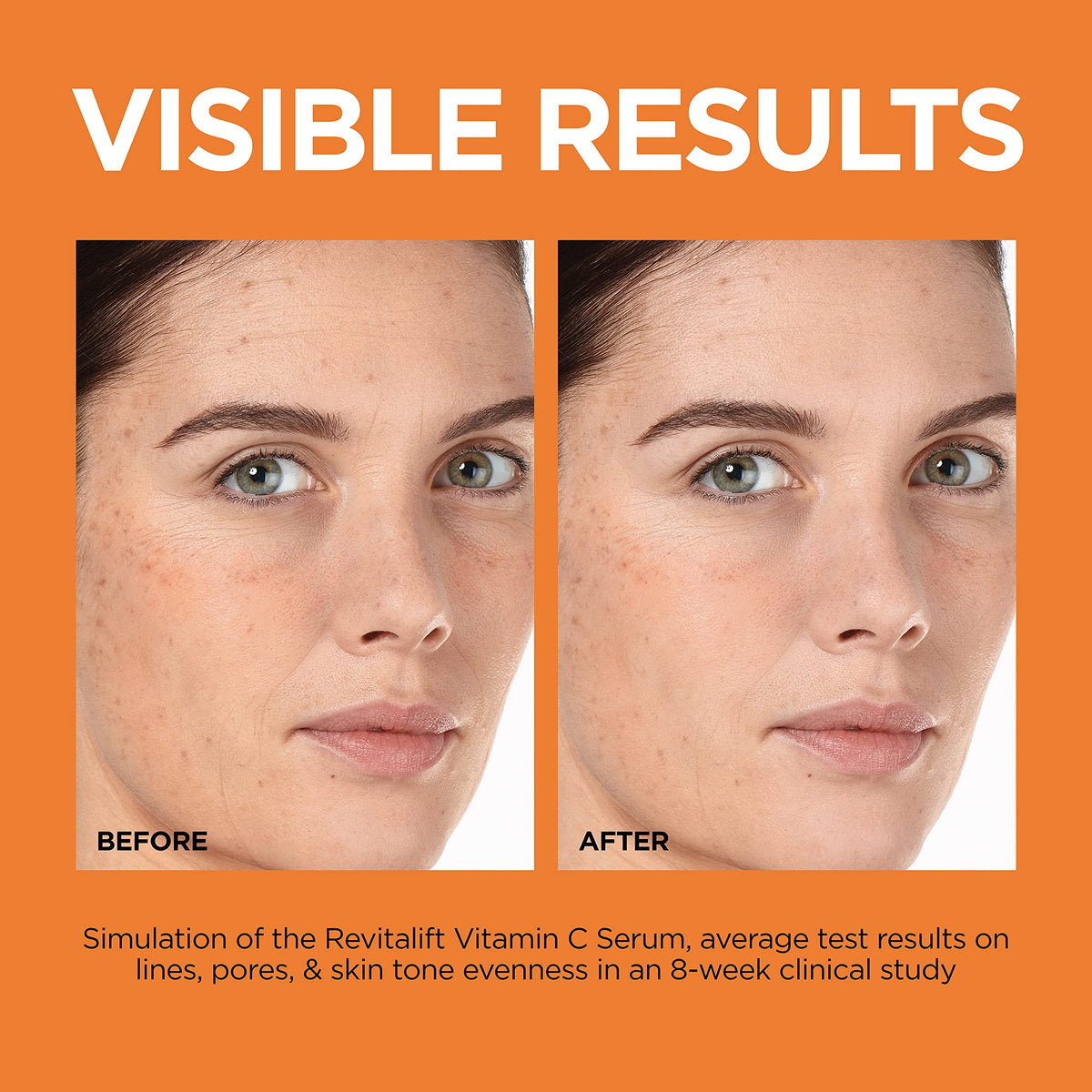 Vitamin C Brightening Face Serum with Vitamin E, Salicylic Acid, 1 oz V276
